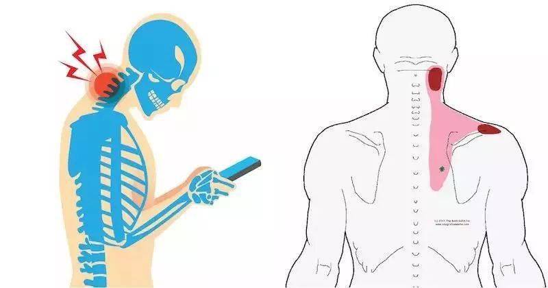 16个瑜伽私教老师常用的理疗肩颈动作超级星空体育app有效！(图1)